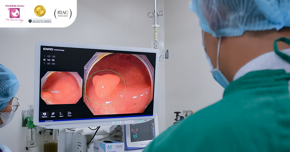 Nội soi trí tuệ nhân tạo là một bước dột phá mới trong lĩnh vực y học tiêu hóa
